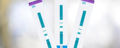 Schnelltest HIV