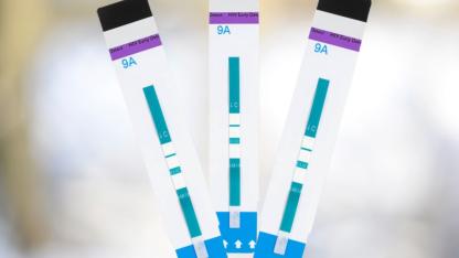 Schnelltest HIV